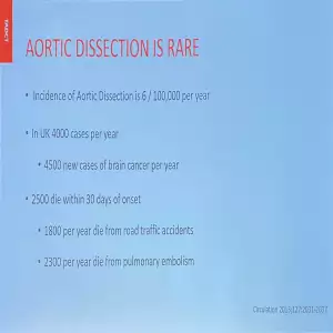 Aortic Dissection is Rare